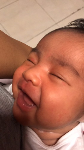 หน้าเป็นผื่นแดง