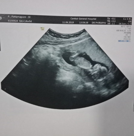 14 week จ้าาาา