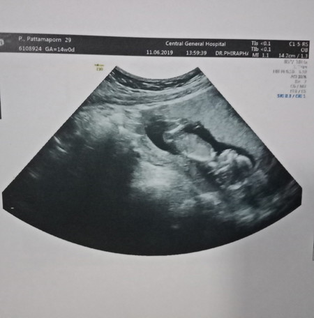 14 week จ้าาาา