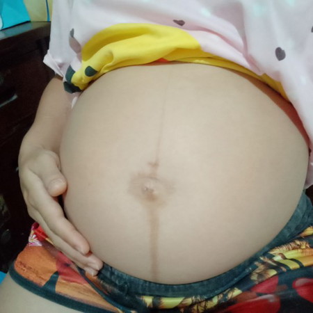 อวดๆ ท้อง กลมๆ