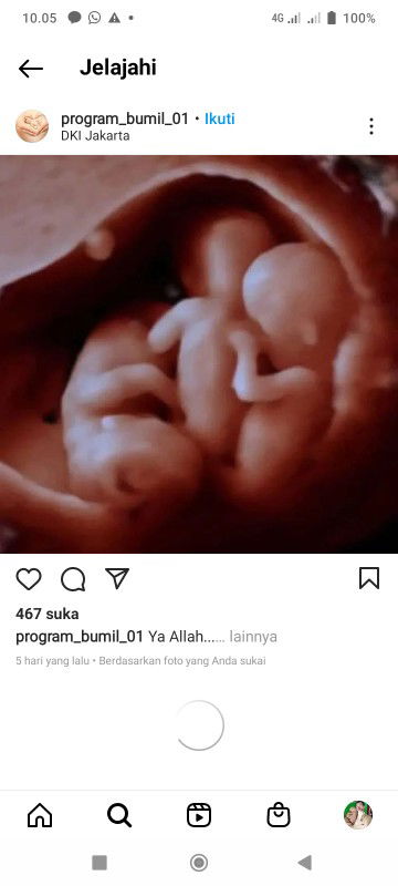 AprilZu 1910 profile icon