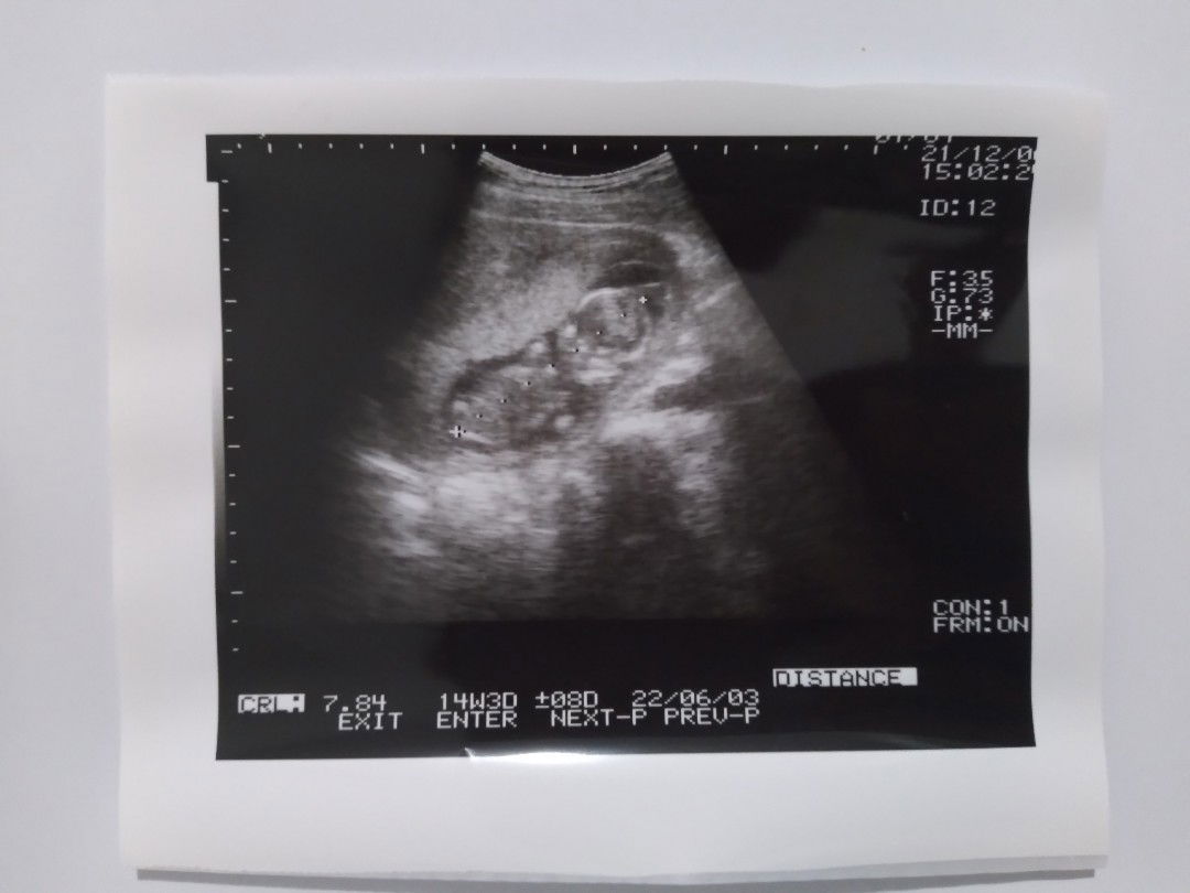 Acacacaca profile icon