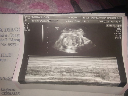 its a girl