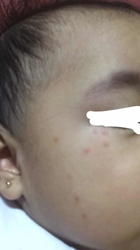 Ano ito