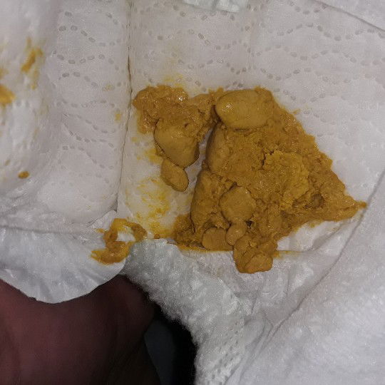 my son is 3 weeks and 1 day old he is formula fed,  how do i know if enfamil is making him constipated?