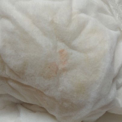 pipis bayi merah muda