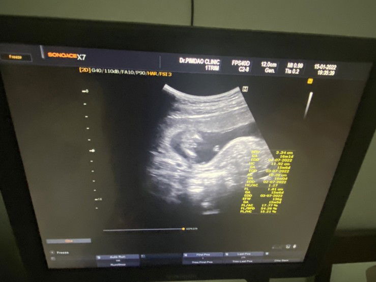 จรว profile icon