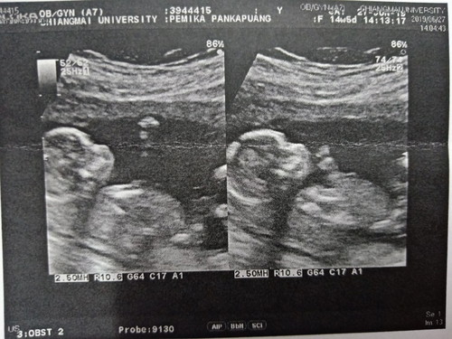 ครั้งแรกที่เห็นลูก 15w