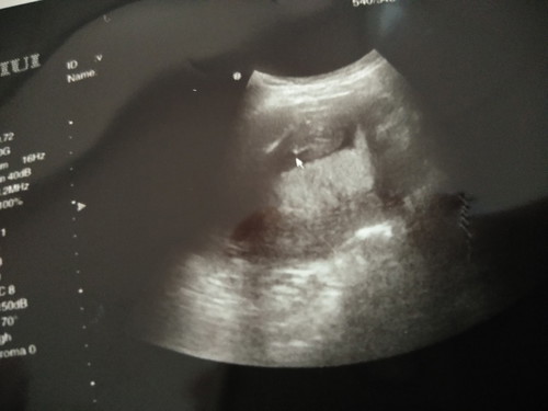 ช่วยดูเพศหน่อยค่ะ