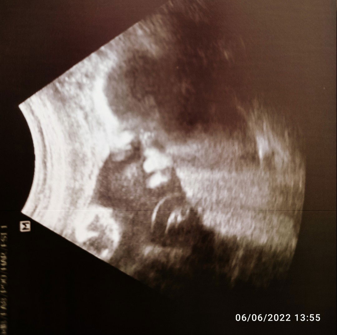 A'isha Manangat profile icon