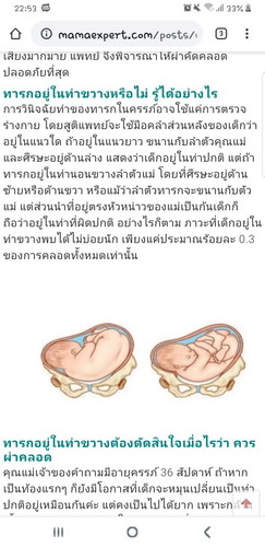 ท่านอนทารกในครรภ์