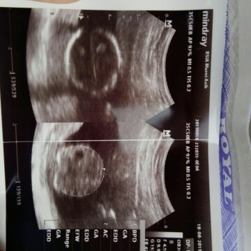 POSISI BAYINYA YANG MANA?