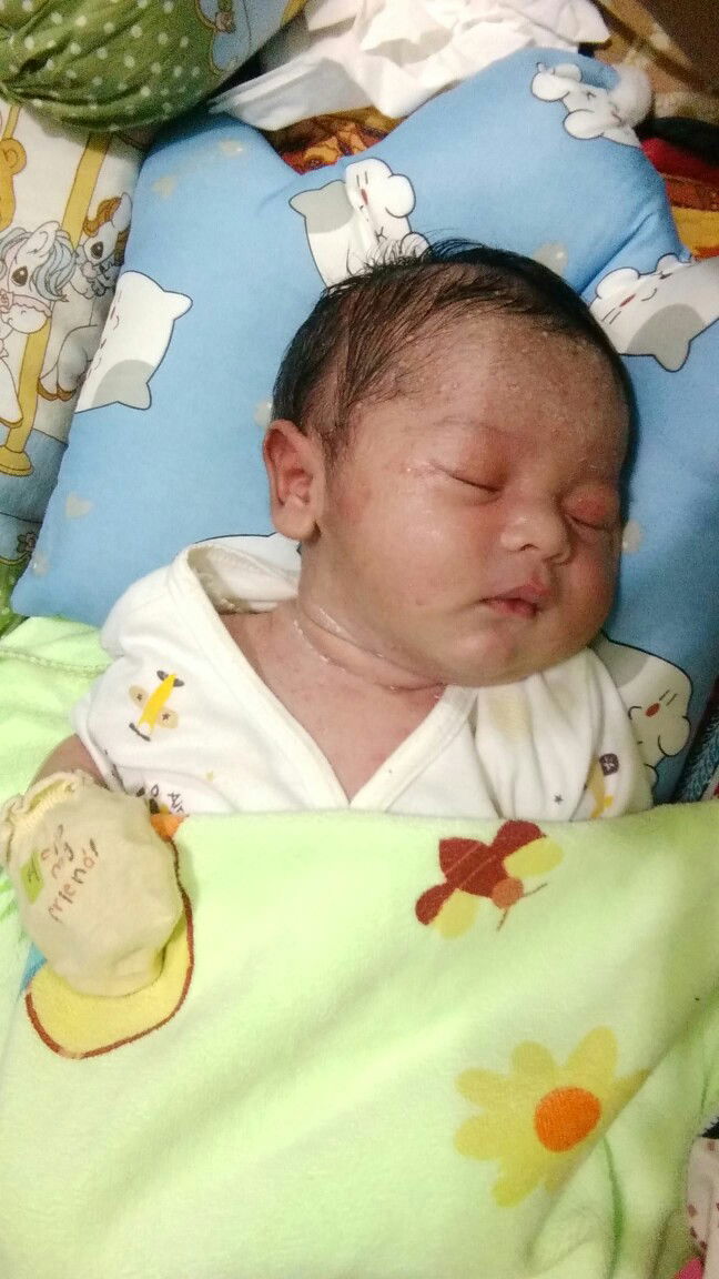 alergi/biang keringat?