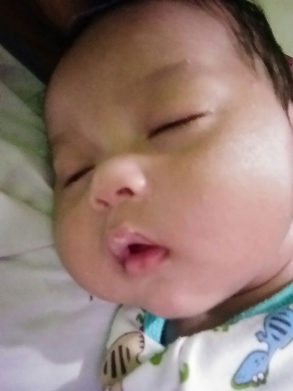 cara sembuhin mata yang belekan