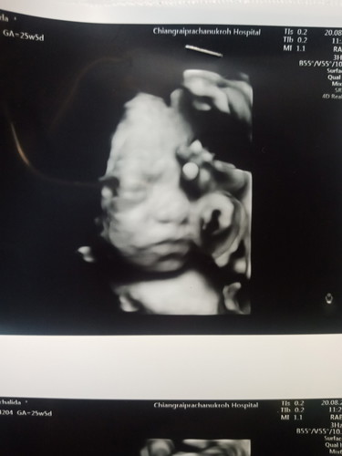 ซาว4D ตื่นเต้นมาก