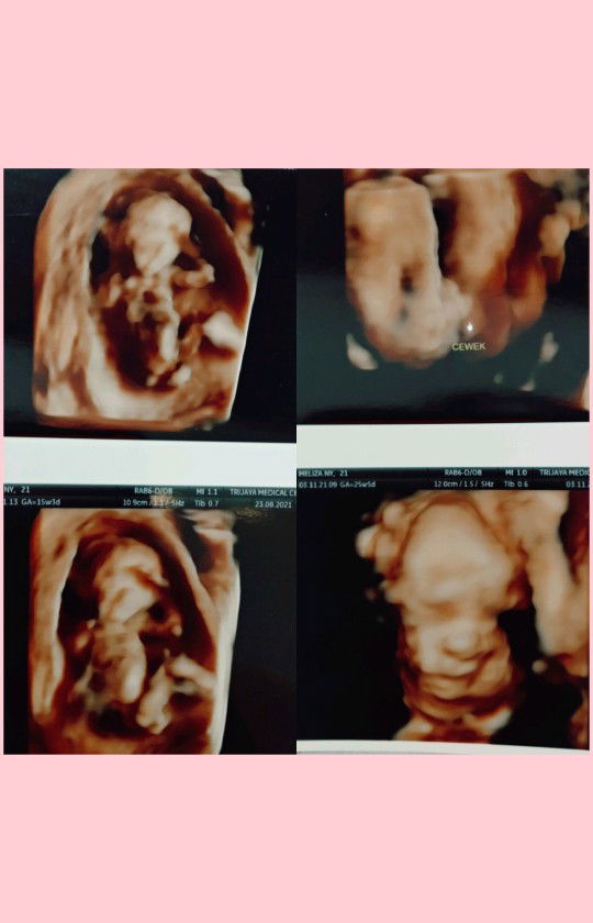 Mellyza Indriani profile icon