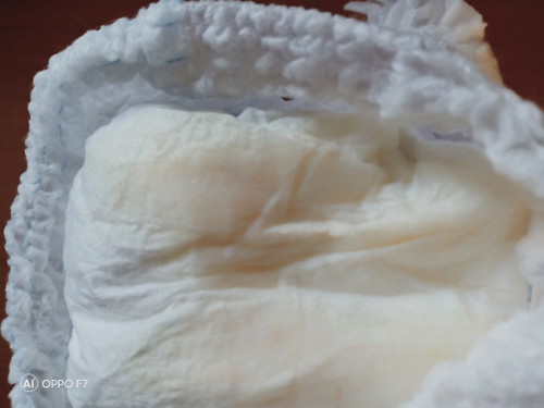 bayi 5 bulan kencing Ada darah warna muda