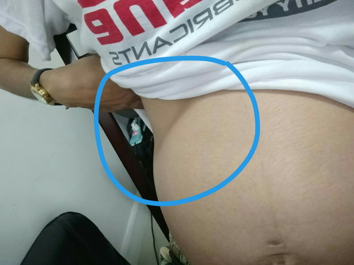 เจ็บทรมาน