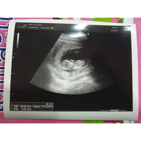 12 weeks 4 days