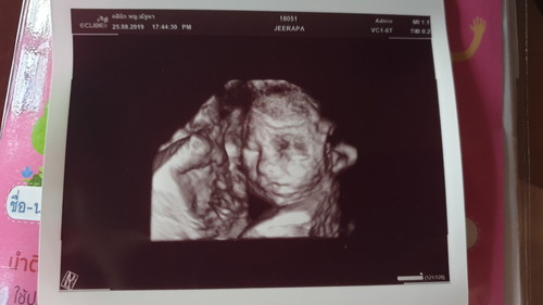My 23 week ultrasound!!