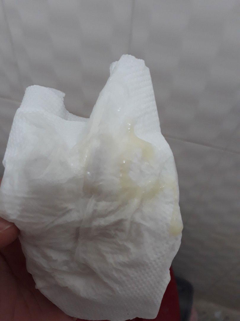 Mucus plug po ba ito?