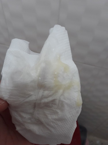 Mucus plug po ba ito?