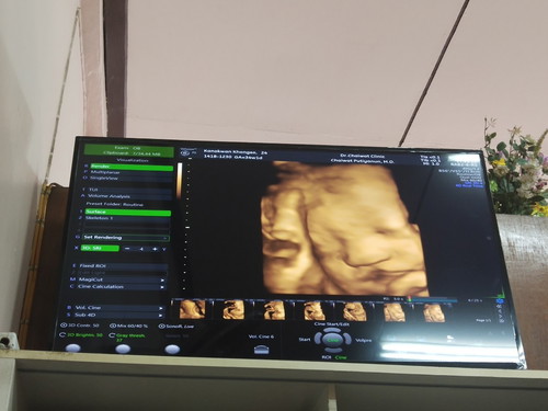 ยินดีด้วยคุณได้ลูกสาว????