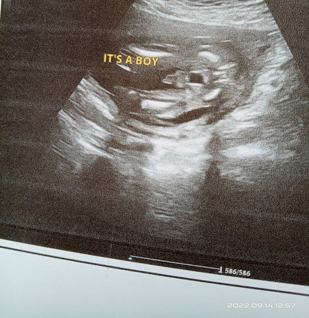 Gender
Ade ke scan boi keluar girl..selalunya scan girl yang banyak kluar boi...nak