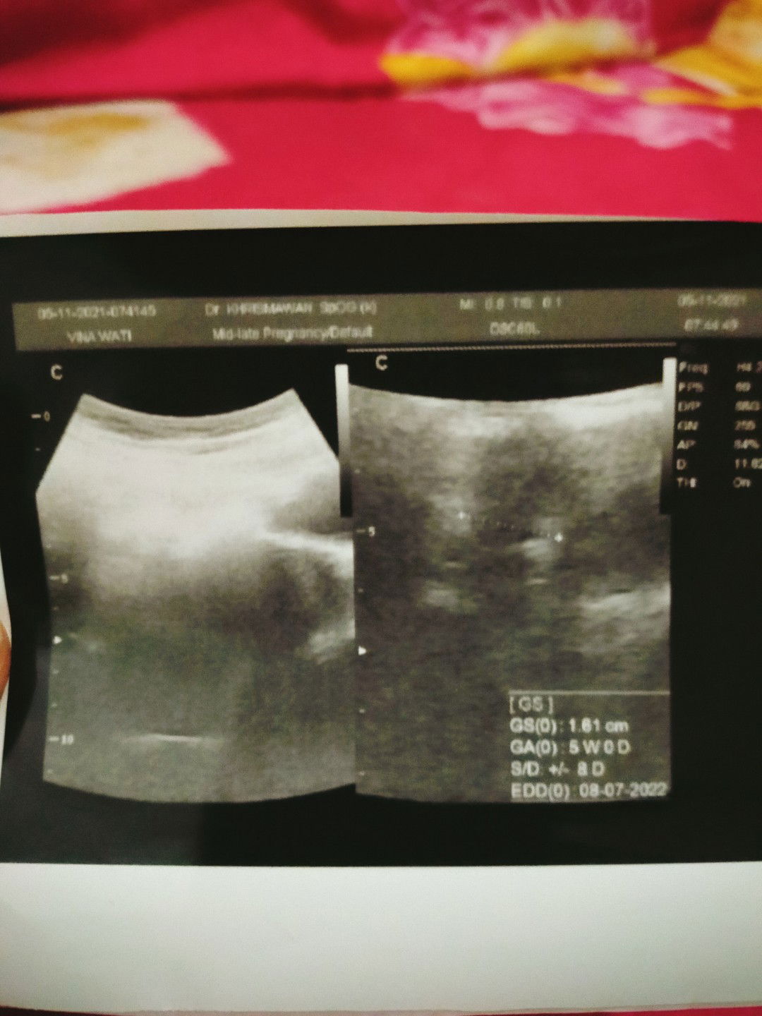 vinawati trisnadewi profile icon