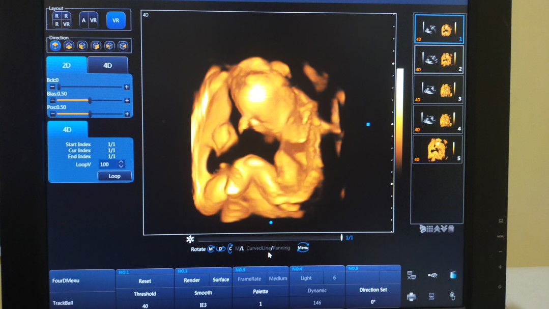 Fery Madrid profile icon