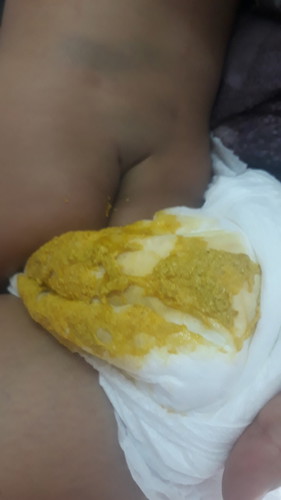 ลูกถ่ายบ่อยมาก