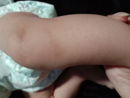 turning 2months baby girl ?