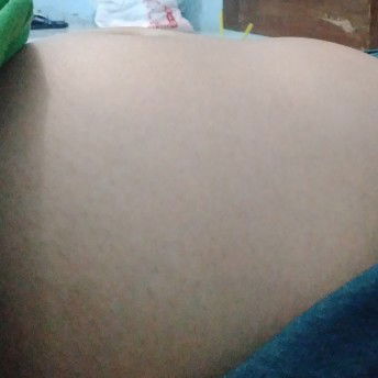 sakit bagian perut kanan bawah