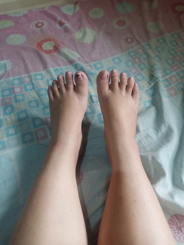 SIGN NG MALALA NA MANAS?