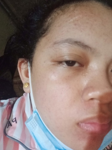 Butlig Butlig sa mukha.