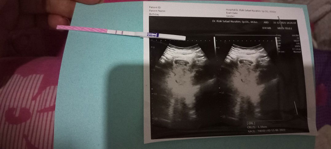 patmawati profile icon