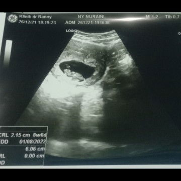 Nur 'aeni profile icon