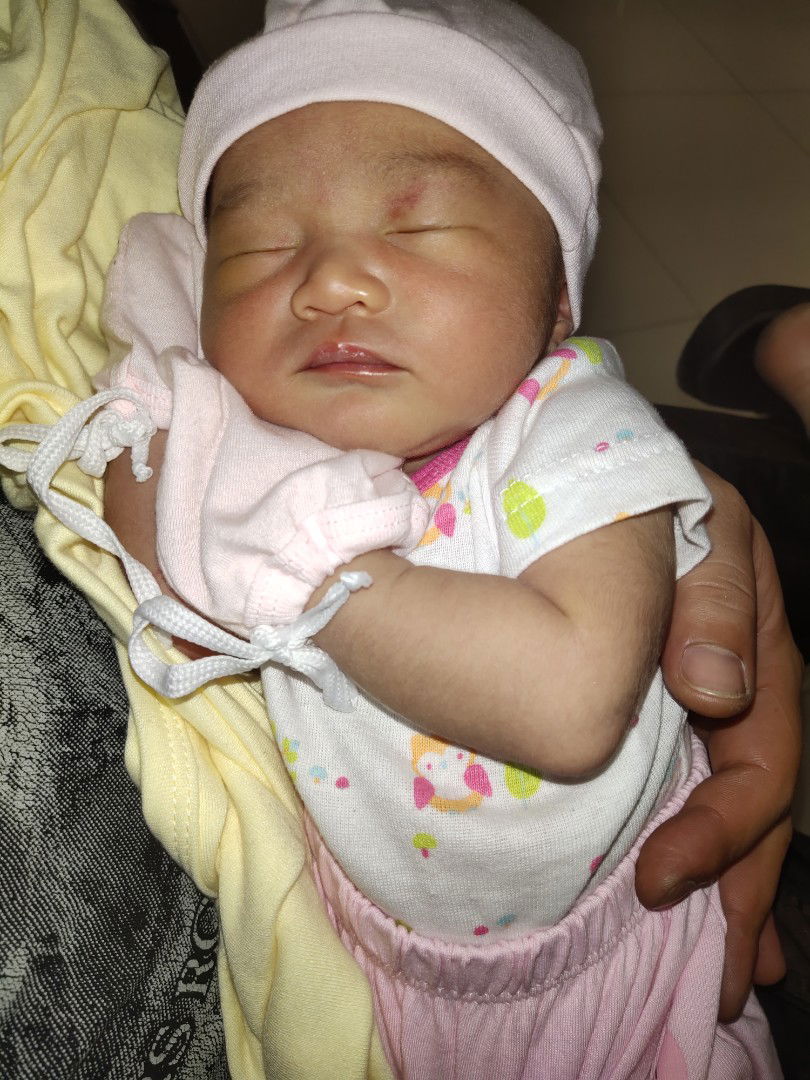 may balat ang lo ko sa mata pa