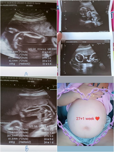 นับวันรอเจ้าแฝดด