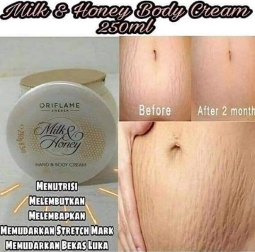 stretchmarks