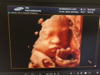 Rachaneekon profile icon