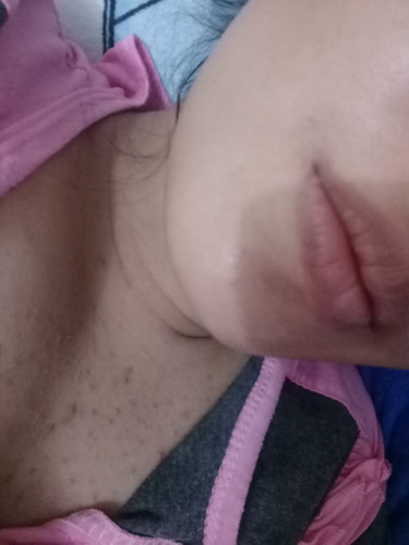 gatal gatal..