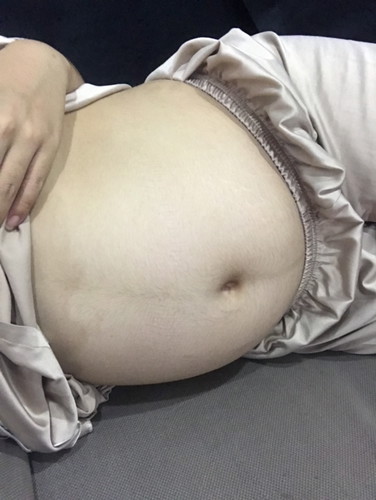 ขนหน้าท้อง