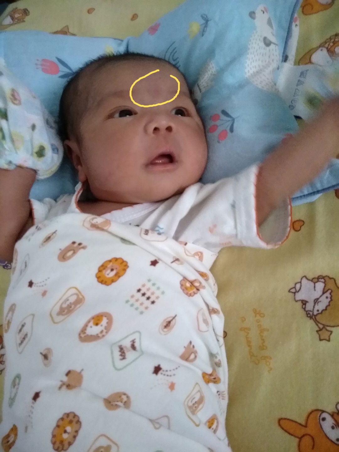 tanda merah dari lahir