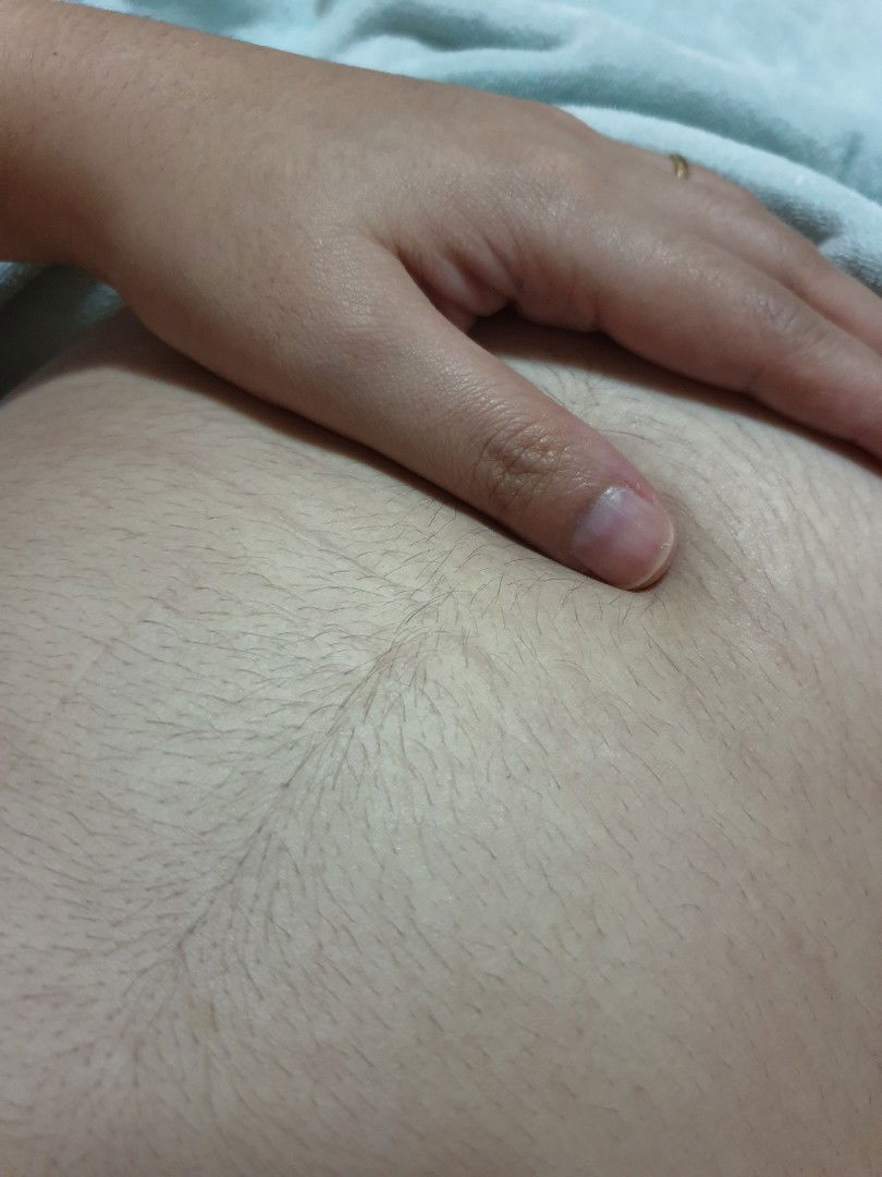 ตอนท้องใครมีขนดกแบบนี้มั้ยคะ?