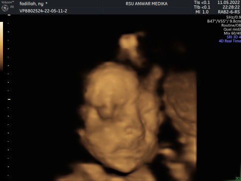 Fadilah Rozaini profile icon