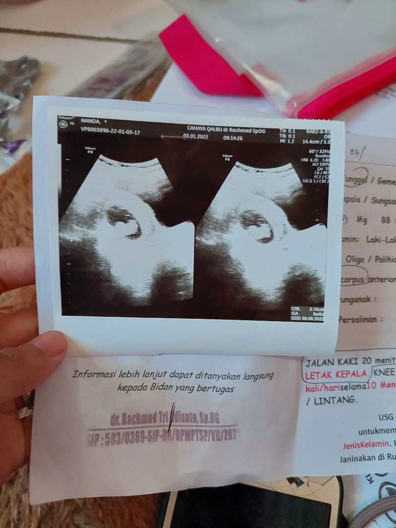 Nanda Nur Ichsan Maulani profile icon