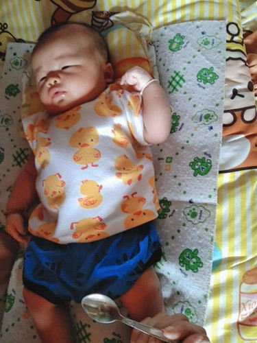 กังวลลูกไม่อุจจาระมาหลายวันแล้ว?