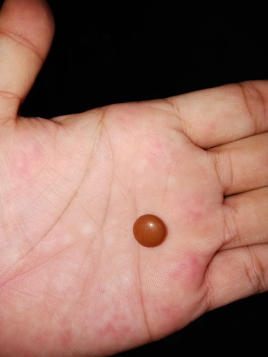 ferrus sulphate