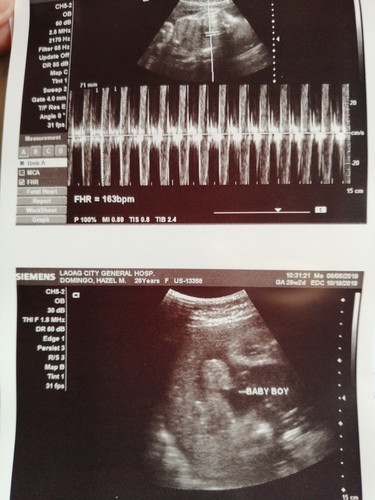 Ultrasound result